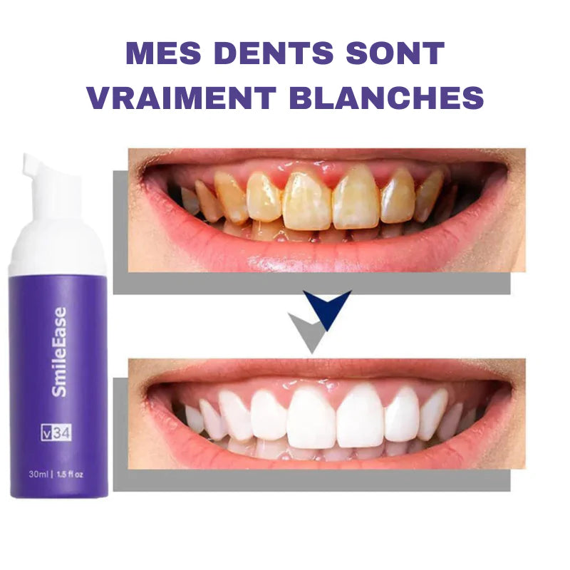 Sérum Correcteur V34 Dentifrice spécialisé dans le blanchiment des dents